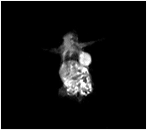 Figure 2. Tumour imaging after injection of nanoprobe.