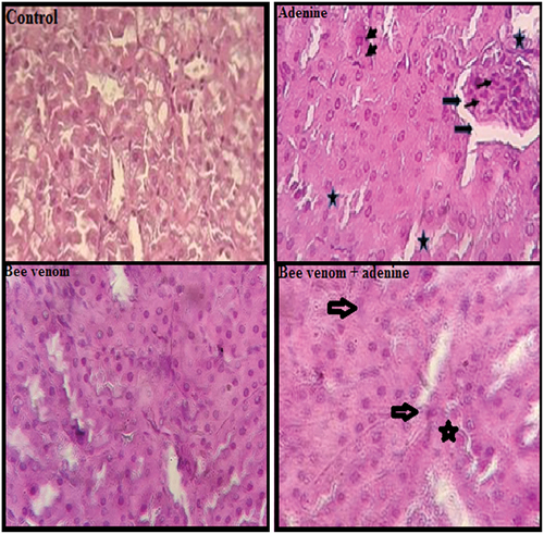 Figure 6. Hematoxylin and eosin staining of renal tissue (400x). Control mice and bee venom (0.7mg/kg bwt, ip) treated mice, showing normal renal histological structure and architecture. Adenine (50mg/kg bwt, ip) treated mice showing tubular necrosis (small arrow), glomeruli inflammation (Star), enlarged capsular space (thin arrow), and inflammatory cells (head arrow). Adenine + bee venom treated mice showing slight glomeruli tubular necrosis alterations. Scale bar: 50 µm.