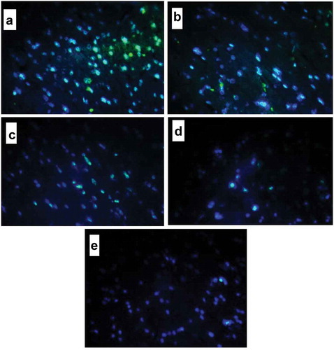 Figure 6. Microscopy of liver samples in diabetic rats through TUNEL procedure. Green stains denote apoptotic cells. (a) control diabetic rats; (b) diabetic rats receiving gavage of pure walnut oil without fortification with β-sitosterol; (c) diabetic rats receiving gavage of walnut oil with low dose of β-sitosterol; (d) diabetic rats receiving gavage of walnut oil with medium dose of β-sitosterol; (e) diabetic rats receiving gavage of walnut oil with high dose of β-sitosterol.