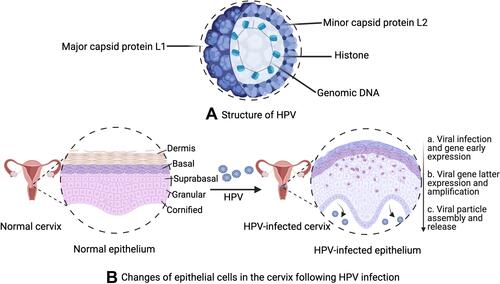 Figure 2 (A) Structure of HPV; (B) changes of epithelial cells in the cervix following HPV infection. (B): a. Viral infection and its early gene expression phase: HPV virus invade the basal layer of the stratified epithelium and initiates early gene (E1 and E2) expression. The oncogenic virus quickly amplifies into 50–100 copies per cell in E1- and E2-dependent manners, with a low copy number of HPV episomes maintained via replication with cellular DNA; b. Viral gene latter expression and amplification phase: one infected cell remains in the basal layer, while other cells continue to enter the suprabasal layer. The episomal DNA sequence of HPV diffuses into the nucleus of infected cells. There, it undergoes genetic replication and assembly; c. Viral particle assembly and release phase: the life cycle is directly controlled by differentiation of the host cell, where HPV viruses are released from keratinocytes.