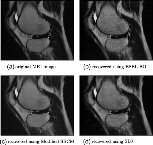 Figure 4. MRI-ankle original and recovered images of size 256×256.