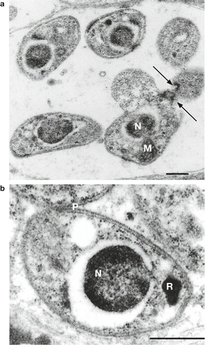 Figure 4. Higher-power transmission electron micrographs of Plasmodium spp.-like merozoites within pulmonary endothelial cells of a mohua (Bird 5) which died due to infection with Plasmodium spp., demonstrating (a) a clump of merozoites showing polar rings (arrows) and a single mitochondria (M) behind the nucleus (N), and (b) a single merozoite with a pear-shaped rhoptry (R) and broken-down pellicular complex (P) (bars=0.5 µm).