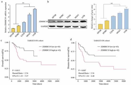 Figure 1. ZDHHC19 was upregulated in OS and predicted poor prognosis. The expression status of ZDHHC19 in OS cell lines (U2OS, MG63 and 143B) and the normal human bone cells (HFOB and HOBC) at mRNA (a) and protein levels (b) were determined by RT-qPCR and Western blot, respectively. Kaplan-Meier survival curves of overall survival (c) and disease-free survival (d) between high ZDHHC19 expression group and low ZDHHC19 expression group in TARGET database. *P < 0.05; **P < 0.01.