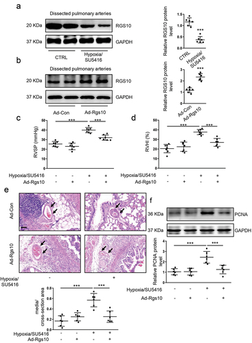 Figure 4. Overexpression of RGS10 ameliorates PH in vivo. (a) the relative protein level of RGS10 in dissected PAs of hypoxia/SU5416 PH mice was measured by immunoblotting (n = 6 samples per group). Hypoxia/SU5416 PH mice indicate chronic hypoxia-induced pulmonary arterial hypertension mice, which were induced by SU5416 injection and hypoxia exposure. (b) the relative expression of RGS10 in dissected PAs of mice transfected by Ad-Con or Ad-Rgs10 were analyzed by immunoblotting (n = 6 samples per group). RVSP (c) and RVHI (d) of hypoxia/SU5416 PH mice were analyzed (post hoc for LSD test; n = 7 samples per group). RVSP: right ventricular systolic pressure. RVHI: right ventricular hypertrophy index. (e) Representative H-E staining and corresponding quantification of lung tissues in control and hypoxia/SU5416 PH mice after transfection of Ad-Con or Ad-Rgs10 (post hoc for LSD test; n = 6 samples per group). The black arrows indicate PAs within lung tissues. Bar = 50 μm. (f) the relative expression of PCNA in dissected PAs of hypoxia/SU5416 PH mice transfected by Ad-Con or Ad-Rgs10 were analyzed by immunoblotting (post hoc for LSD test; n = 6 samples per group). Data are shown as mean ± S.D. ***P < .001 denotes statistical comparison between the two marked groups.