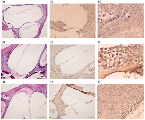 Figure 1. The apoptosis with TUNEL and haematoxylin–eosin staining in Control Group, Cisplatin Group and Cisplatin + Pycnogenol® Group. (a) Control Group – Corti H&E (b) Control Group – Corti TUNEL (c) Control Group – spiral ganglion TUNEL (d) Cisplatin Group – Corti H&E. (e) Cisplatin Group – Corti TUNEL. (f) Cisplatin Group – spiral ganglion TUNEL (g) Cisplatin + Pycnogenol® Group – Corti H&E. (h) Cisplatin + Pycnogenol® Group – Corti TUNEL. (i) Cisplatin + Pycnogenol® Group – spiral ganglion TUNEL.