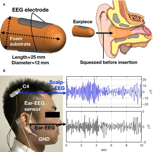 Figure 2 The in-ear EEG sensor.
