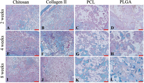 Figure 5. Alcian blue staining showed proteoglycan accumulation (blue color) in chitosan (A), (E), (I), collagen type II (B), (F), (J), PCL (C), (G), (K) and PLGA (D), (H), (L) at 2 (A)–(D), 4 (E)–(H) and 8 (I)–(L) weeks. Scale bars = 100 μm.