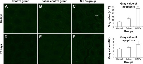 Figure 5 The effects of SiNPs on the apoptosis of spermatogenic cells in testis of mice.Notes: (A–C) The apoptotic cells were confirmed by TUNEL in every group on the 45th day after the first dose. The apoptotic cells were observed by a fluorescence microscope. SiNPs increased the proportion of apoptosis cells. (D–F) The apoptotic cells were confirmed by TUNEL in every group on the 75th day after the first dose. The apoptosis in the SiNPs group and the saline control group displayed no significant difference on the 75th day after the first dose. The apoptosis of spermatogenic cells was detected by TUNEL assay. Data are expressed as the mean ± standard error from three independent experiments. *P<0.05 vs the saline control group. The white arrow represents the apoptosis of cells. Saline group represents the saline control group. The data indicated that SiNPs could increase the apoptosis of spermatogenic cells.Abbreviations: SiNPs, silica nanoparticles; TUNEL, terminal deoxynucleotidyl transferase (TdT)-mediated dUTP nick-end labeling.