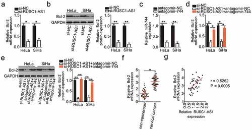 Figure 4. RUSC1-AS1 sponges miR-744 and consequently increases Bcl-2 expression in cervical cancer cells. (a, b) The mRNA and protein levels of Bcl-2 in HeLa and SiHa cells transfected with either si-RUSC1-AS1 or si-NC were measured by RT-qPCR and western blotting, respectively. (c) RT-qPCR was conducted to determine the efficiency of antagomir-744 transfection. (d, e) HeLa and SiHa cells were cotransfected with si-RUSC1-AS1 and either antagomir-744 or antagomir-NC. The amounts of Bcl-2 mRNA and protein were determined via RT-qPCR and western blotting, respectively. (f) Bcl-2 mRNA expression in the 45 pairs of cervical cancer tissue samples and adjacent noncancerous tissue samples was examined by RT-qPCR. (g) Spearman’s correlation analysis was performed to assess the relation between Bcl-2 mRNA and RUSC1-AS1 expression levels in cancerous tissues (r = 0.5262; P = 0.0005). *P < 0.05 and **P < 0.01