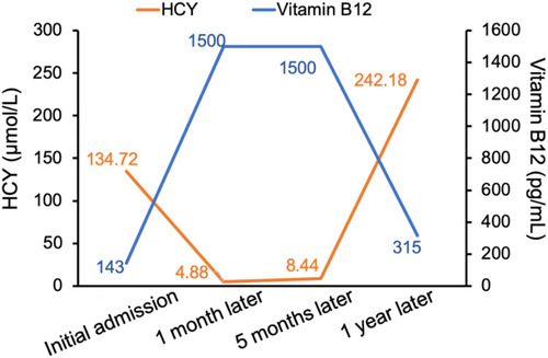 Figure 2 The serial serum vitamin B12 and HCY level during 12 months follow-up.