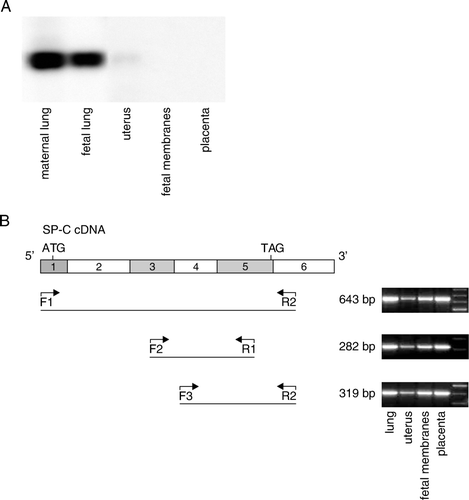 Figure 2.  SP-C transcript is similar in mouse lung and gestational tissues. A: For Northern blot the mouse tissues were harvested from PBS-treated mice at 17 dpc. The amount of total RNA used was 10 µg for mouse lung and 30 µg for other mouse tissues. B: In schematic representation of mouse SP-C cDNA the exons are indicated as numbered boxes, and start and stop codons are shown. The locations of primers (F1, F2, F3, R1, and R2) used in the validation of mouse extrapulmonary SP-C cDNA and lengths of the PCR products of SP-C cDNA are indicated. The PCR products were electrophoresed and further verified by sequencing. PBS: phosphate-buffered saline, SP-C: surfactant protein C, PCR: polymerase chain reaction.
