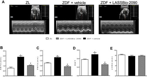 Figure 3 Effects of the intraperitoneal treatment with vehicle or LASSBio-2090 (100 µmol/kg/day) on LV wall thickness. Figure (A), representative images obtained by M-mode echocardiography. Figures (B and C), anterior (B) and posterior (C) wall thickness at diastole. Figure (D), relative left ventricle wall thickness. Figure (E), left ventricle internal diameter at diastole. Data represent the mean ± SEM (n = 6 rats per group). *p < 0.05 compared with ZL group; #p < 0.05 compared with ZDF group treated with vehicle. Ordinary one-way ANOVA with Dunnett’s multiple comparisons test.