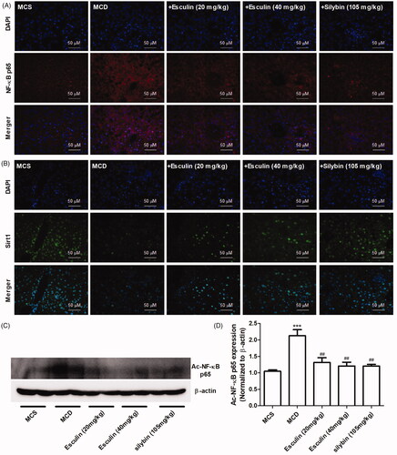 Figure 4. Esculin inhibits the acetylation of NF-κB in MCD diet-induced mice. (A) Representative immunofluorescence images of the NF-κB p65 protein in the liver of each group (400× magnification, scale bar: 50 µm). (B) Representative immunofluorescence images of the Sirt1 protein in the liver of each group (400× magnification, scale bar: 50 µm). (C) Western Blot analysis of ac-NF-κB p65. (D) Densitometric analyses of ac-NF-κB p65. Data are expressed as mean ± SEM, n = 3. ***p < 0.001 vs. MCS group. ##p < 0.01 vs. MCD group. MCS: methionine and choline supplemented; MCD: methionine and choline-deficient.