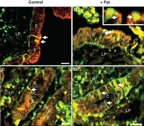 Figure 4. Double labeling with LY and Nile red after culture for 30 min in the absence or presence of fat absorption. (A), (B), (C), (D) Both in the villus region and in the crypts, the LY-permeable enterocytes (marked by arrows) appeared morphologically similar to their LY-negative neighboring cells, both in the control and after fat absorption. In (B), the high-magnification insert shows that two LY-permeable cells had also accumulated fat droplets/chylomicrons. Bars, 20 μm. This Figure is reproduced in color in Molecular Membrane Biology online.