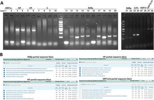 Figure 2. 2nd-round of identification of unusual pneumonia. (A) RNA samples were subjected to multiple primer sets for different genes as indicated. Lane 1, 3, 5, 7, 9, 11, 12, 13, 14, 15, 21, 23, 25, 27 are samples of patient 1. Lane 2, 4, 6, 8, 10, 16, 17, 18, 19, 20, 22, 24, 26, 28 are samples of patient 2. (B) The PCR product of patient 1 and 2 were sequenced and the Blast result is shown.