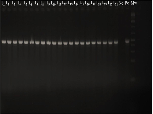 Figure 2 Agarose gel electrophoresis result of PCR product. Legend. Electrophoresis of PCR amplification after serial dilution of Salmonella sample in a 0.5% agarose gel stained with ethidium bromide. Agarose gel electrophoresis of Salmonella PCR products at 496 bp (16SrRNA gene) amplification of target region of histidine transport operon.