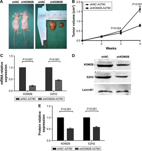 Figure 5 Ovarian tumor growth was inhibited after KDM2B repression in vivo. (A) Tumor volume of the shKDM2B-A2780 group in the nude mouse xenograft model was significantly decreased compared with tumors obtained from the shNC-A2780 group. (B) Tumor volume of the shKDM2B-A2780 group in nude mouse xenograft model was significantly decreased compared to tumors present in the shNC-A2780 group at 3 and 4 weeks (P=0.024 and P<0.001). (C) KDM2B and EZH2 mRNA expression was repressed in the shKDM2B-A2780 group compared with the shNC-A2780 group (P<0.001). (D) Western blot analysis of KDM2B and EZH2 protein in shNC-A2780 and shKDM2B-A2780 groups. (E). EZH2 protein expression was repressed in the shKDM2B-A2780 group compared with the shNC-A2780 group (P<0.001). All assays were repeated three times.