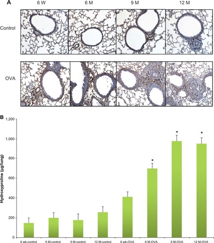 Figure 4 Collagen expression in lung according to age in the acute asthma model. Representative photomicrographs of lung sections stained for collagen III (A) (original magnification × 200) and hydroxyproline concentration in lung tissue (B).Notes: Values shown are mean ± SEM (n = 8–12/group); *P< 0.05, compared with the 6-week-old OVA group.Abbreviations: W, weeks; wk, weeks; M, months; OVA, ovalbumin; SEM, standard error of the mean.