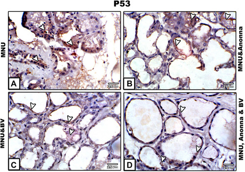 Figure 4 Microscopy of paraffin-embedded sections of breast stained with anti-p53 antibody. (A) MNU; (B) MNU and A. muricata; (C) MNU and BV; (D) MNU, A. muricata, and BV.