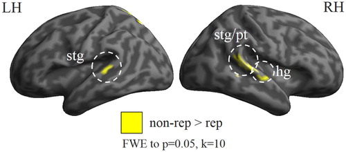 Figure 3. Effect of stimulus repetition in dichotic listening on the BOLD response. Results from an fMRI study on N = 113 subjects (age: 29.3 ± 7.1 years; 49 females) using sCV syllables as stimulus material. Stronger activation in trials which did not contain a repeated stimulus (non-rep), as compared to trials which repeated a stimulus from a preceding trial (rep). Significant activation differences were found bilaterally in superior temporal gyrus (stg) and planum temporale (pt), as well as in the right Heschl’s gyrus (hg). Family-wise error correction (FWE) to p = .05 and a cluster threshold of 10 voxels were applied. Reported in Westerhausen et al. (Citation2014b); reanalysed data from Kompus et al. (Citation2012).