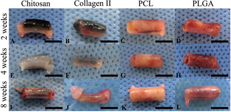 Figure 3. Chondrocytes were seeded onto chitosan (A), (E), (I), collagen type II (B), (F), (J), PCL (C), (G), (K) and PLGA (D), (H), (L), respectively and cultured in the in vivo bioreactor for 2 (A)–(D), 4 (E)–(H) and 8 (I)–(L) weeks. The gross examination pictures showed degradation of materials at different time points. Scale bars = 5 mm.