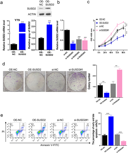 Figure 2. SUSD2 promotes apoptosis and inhibits proliferation of retinoblastoma cells. SUSD2 was successfully overexpressed (a) or silenced (b) in Y79 cells, along with (c) viability, (d) colony proliferation, and (e) apoptosis of Y79 cells. ***P < 0.001.