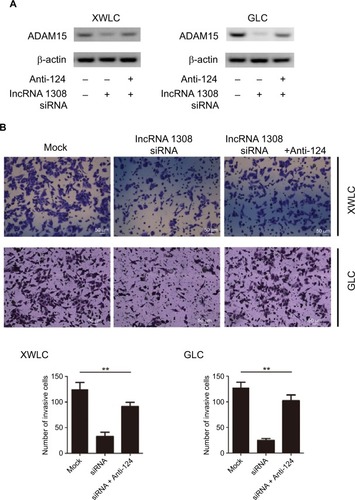 Figure 6 lncRNA 1308 acts as a ceRNA to regulate ADAM 15 levels and suppresses cell invasion in lung cancer cells.Notes: (A) lncRNA 1308 acts as a ceRNA to inhibit ADAM 15 expression in lung cancer cells. XWLC and GLC cells were transfected with lncRNA 1308 siRNA and/or infected with miR-124 inhibitors, and the expression of ADAM 15 was analyzed by Western blotting. (B) lncRNA 1308 acts as a ceRNA to inhibit cell invasion. XWLC and GLC cells were transfected with lncRNA 1308 siRNA and/or infected with miR-124 inhibitors, and the invasive ability of cells was evaluated by in vitro invasion assays. Results are presented as mean ± SD. **P<0.01. Anti-124, miR-124 inhibitor. Magnification 100×.Abbreviations: ADAM15, a disintegrin and a metalloproteinase 15; ceRNA, competing endogenous RNA; GLC, Gejiu lung cancer; lncRNA 1308, long non-coding RNA 1308; XWLC, Xuanwei lung cancer.