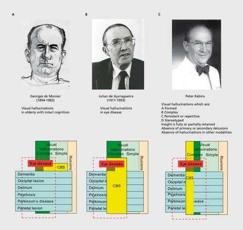 Figure 1. The three Charles Bonnet syndromes (CBS). Key figures in the history of each syndrome are shown, together with their definition and a representation of the patients included. Blue rectangles = conditions associated with visual hallucinations; light green (simple) and dark green (complex) rectangles = visual hallucinations, red dashed rectangle = eye disease. The subset of patients with CBS is shown in yellow, darkened for those patients common to all three definitions. The size of each rectangle or its regions of intersection are not indicative of the number of patients involved. See text for further details. Portrait of de Morsier reproduced with permission of the Centre d'iconographie Genevoise, coll. BPU University of Geneva. Photo of de Ajuriaguerra reproduced with permission of the University Hospital of Geneva. Photo of Peter Rabins reproduced with permission of Dr Rabins.