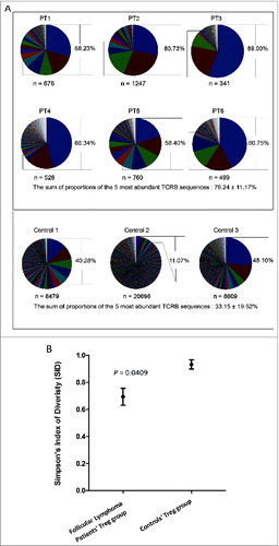 Figure 1. Clonal diversity of regulatory T cells in FL tissue. (A) All TCRβ sequences were collected to show the individual Tregclonotypic diversity in 6 FL patients compared with 3 controls. Colors present clonal abundance in each subject by percentage of in-frame sequencing counts. The sum of proportions of the 5 most abundant TCRβ sequences is represented by percentage and compared between FL patients and controls using a two-tailed Student's t-test (P = 0.0238); n = clone number by identified TCRβ sequences (in-frame reads). (B) Simpson's Index of Diversity (SID; see text and equation in Materials and Methods) was used to measure Treg TCRβ sequence diversity between FL patients and controls (P = 0.0409).