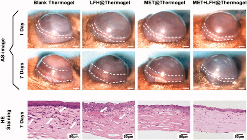 Figure 5. Inhibition of CNV by different treatments in alkali burn induced corneal injury model. (A) Representative cornea images of one day after alkali burn and seven days after alkali burn with different treatment. (B) Representative H&E staining at seven days after alkali burn of different treatment (scale bar = 50 μm). White arrows point out the neovessels.