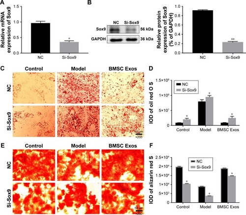 Figure 6 Effect of Sox9 on osteogenesis of BMSCs.