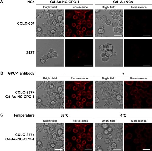 Figure 4 Confocal fluorescence images of in vitro cell uptake of Gd-Au-NC-GPC-1 at Au concentration of 0.46 mM. (A) COLO-357 and 293T cells were incubated with Gd-Au-NC-GPC-1 or Gd–Au NCs at 37°C for 2 hours. (B) COLO-357 cells were preincubated with or without GPC-1 antibody (dilution rate, 1:50) at 37°C for 2 hours. After discarding GPC-1 antibody and washing target cells with PBS 2 times, COLO-357 cells were incubated with Gd-Au-NC-GPC-1 at 37°C for another 2 hours. (C) COLO-357 cells were incubated with Gd-Au-NC-GPC-1 at 37°C or 4°C for 2 hours. Bar, 25 μm.Abbreviations: Gd-Au-NC-GPC-1, Gd–Au NCs conjugated with GPC-1 antibody; GPC-1, Glypican-1; NCs, nanoclusters.