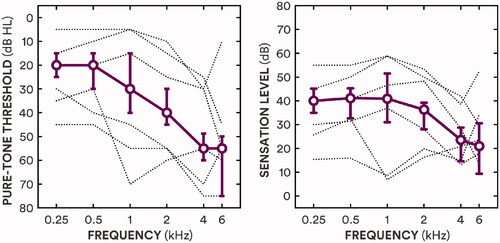 Figure 1. The left panel shows median pure-tone thresholds as a function of frequency (circles, solid line) and interquartile ranges (error bars), with the individual thresholds for the three lowest and highest average thresholds (dotted lines). The right panel shows median sensation levels (approximated from pure-tone thresholds and applied gain) as a function of frequency (circles, solid line) and interquartile ranges (error bars), with the individual values for the three lowest and highest average sensation levels (dotted lines).