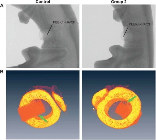 Figure 9 Radiographs and SRμCT scan of a beagle’s mandible with bare and micromodified threaded PEEK/n-HA/CF ternary implants for 8 weeks of implantation.Notes: (A) Radiographs and (B) SRμCT scan of a beagle’s mandible. The green arrows refer to the interfaces between bone tissue and implants.Abbreviations: PEEK/n-HA/CF, carbon fiber-reinforced polyetheretherketone–nanohydroxyapatite; SRμCT, synchrotron–radiation-based computer microtomography.