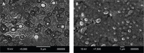 Figure 5 Surface morphology of the selected fast dissolving niosomal film and niosomal dispersion.