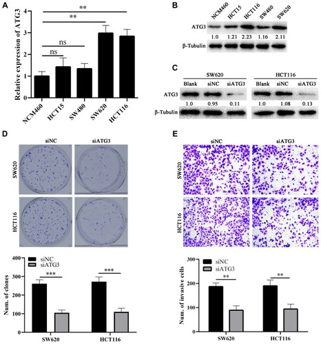 Figure 2 ATG3 knockdown inhibits proliferation and invasion of colon cancer cells.Notes: qPCR (A) and Western blot (B) show that ATG3 is upregulated in colon cancer cells compared with colon epithelial cell NCM460. (C) Western blot indicates that ATG3 is successfully knocked down in SW620 and HCT116 cells. ATG3 knockdown significantly suppresses proliferation and invasion of colon cancer cells demonstrated by plate clone formation (D) and Transwell assays (E). siNC stands for negative control small RNA; Ns stands for no significant difference; **Stands for P < 0.01; ***Stands for P < 0.001.