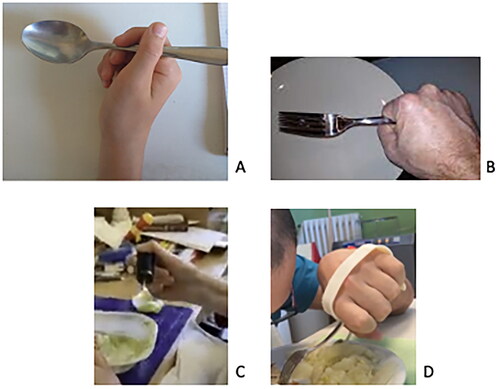 Figure 1. (A) The three finger clenched grip or transverse digital radial grip is commonly used by most people. (B) The transverse palmar grip (power grip) may be less suited for holding forks and spoons, but may be used as an alternative to the clenched grip. (C) Holding a spoon having a standard build-up handle thickening the shaft to facilitate clenching between thumb and index fingers. (D) Eating with a cuff-based device. The transverse palm grip is an option for people with impaired finger flexion strength e.g., resulting from cervical spinal cord injury.