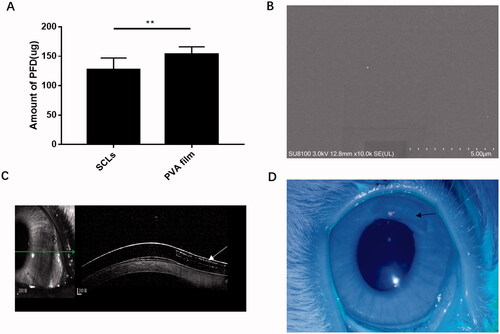 Figure 1. Amount of loaded drug and pictures of soft contact lenses in scanning electron microscope, coherence tomography scan, and eyes of rabbits. (A) In vitro measured amount of PFD loaded in PVA film and SCLs were 153.515 μg ± 12.508 and 127.438 μg ± 19.674, respectively, the data were plotted as mean ± SDs (n = 5 and 44, respectively) (**p<.01); (B) picture of scanning electron microscope of SCLs; (C) picture of coherence tomography scan of SCLs, the white arrow indicated the shape of PFD loaded PVA film; (D) picture of SCLs in eye of rabbit, the black arrow means the PFD loaded crescent area in SCLs.