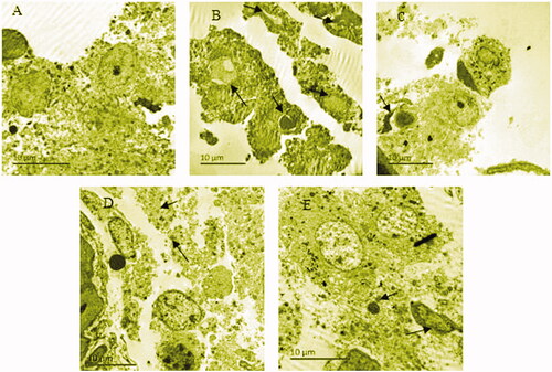 Figure 3. Ultrastructure of Leydig cells of rats of normal group (A), model group (B), arrowheads indicate many mitochondrial vacuoles were changed. Epimedii folium extract (EFE) group (C), arrowhead indicates ruptured cell membranes. Low-dose Bushen Yiyuan recipe (BYR) group (D), arrowheads indicate lysosomes increased. high-dose Bushen Yiyuan recipe (BYR) group (E), arrowheads indicate chromatin of some cells condensed in margin and lysosomes increased.