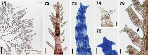 Figs 71–76. Vegetative structures of Spyridia alternans from the New York Botanical Garden (NY #922229). Fig. 71. Vegetative thallus. Fig. 72. Apex of young thallus with determinate branches. Fig. 73. Cortication pattern of determinate branch. Figs 74–75. Spine shapes at apex of determinate branches. Fig. 76. Intersection point of determinate branch on main axis lacking cortication (arrow). Scale bars: Fig. 71 = 2 cm; Fig. 72 = 100 µm; Figs 73–74, 76 = 25 µm; Fig. 75 = 20 µm