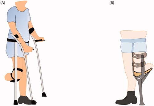 Figure 3. A shows a bent knee pylon; B shows a kneeling bearer connected with a peg leg.
