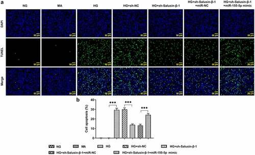 Figure 5. Downregulation of Salusin-β repressed the apoptosis of HG-induced HK-2 cells by suppressing miR-155-5p. (a) TUNEL staining for the assessment of cell apoptosis. (b) Quantitative analysis of cell apoptosis