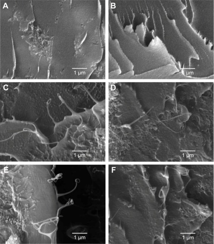 Figure 6 Enhancing mechanisms of carbon-based filler in the nanocomposite scaffolds.Notes: (A) GNSs, pulling out; (B) GNSs, bridging; (C) CNTs, pulling out; (D) CNTs, bridging; (E) CNTs, dangling; and (F) CNTs, entangling with GNSs. Abbreviations: CNTs, carbon nanotubes; GNSs, graphene nanosheets.