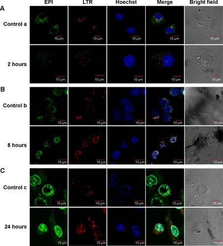 Figure 8 Fluorescence colocalization assay by confocal microscopy to determine biodistribution.Notes: MCF-7 cells were treated with free EPI (controls a, b, and c) or PSSG–EPI for 2 hours, showing weak fluorescence (A), 8 hours, showing stronger green fluorescence at the perinuclear region (B), and 24 hours, showing strong fluorescence in the nucleus (C), respectively.Abbreviations: EPI, epirubicin; PSSG, PSS-decorated nanographene; PSS, poly(sodium 4-styrenesulfonate); LTR, Lyso-Tracker Red.