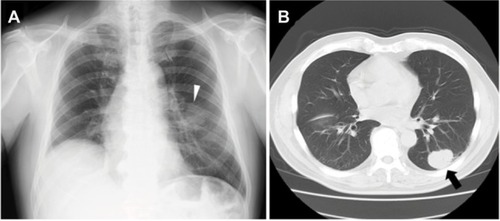 Figure 1 The radiographic findings.