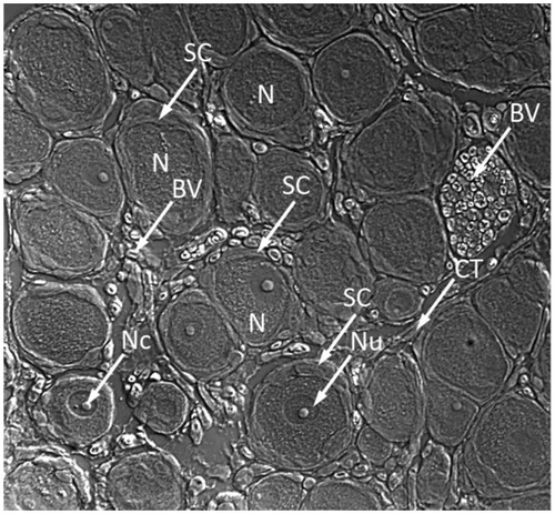 Figure 3 Microphotograph of dorsal root ganglion obtained from frozen section showing juxtaposition of DRG neurons and satellite cells.