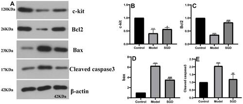 Figure 8 (A) the protein band; (B–E) the protein results of c-kit, Bcl2, Bax, and cleaved caspase-3 in rabbit SO tissue, respectively. The model group vs the control group, ***P ≤ 0.001, the SGD group vs the model group, #P ≤ 0.05, ##P ≤ 0.01, ###P ≤ 0.001.