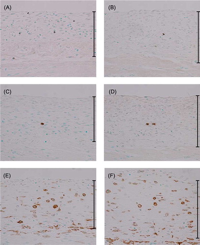 Figure 2. Immunohistochemistry for CD3, CD45R, and F4/80 at day 16. Immunohistochemical detection of CD3-positive (A), CD45R-positive (C) and F4/80-positive (E) cells in the peritoneum of CG-injected WT mice. CG-injected SCID mice were also analyzed for the presence of CD3-positive (B), CD45R-positive (D), and F4/80-positive (F) cells. Magnification, ×200.