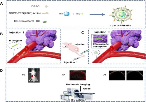 Figure 1 Schematic illustration of the biological targeting synergistic agent. (A) Synthetic procedures for CL-ICG-PFH-NPs. (B, C) Targeting the tumor tissue. (D) Multimode imaging and HIFU ablation.Abbreviations: ICG, indocyanine green; PFH, perfluorohexanes; CL-ICG-PFH-NPs, ICG and PFH coloaded cationic lipid nanoparticles; HIFU, high-intensity focused ultrasound.