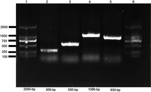Figure S2 Screening of mcr-1 and ESBL encoding genes in E. coli.Notes: PCR product was separated on 1% agarose gel. Lane 1 and 6 shows 2000 bp molecular marker (Vazyme, Beijing, China); Lane 2, (mcr-1), Lane 3 (blaCTX-M) isolate; Lane 4, (blaTEM); and Lane 5 shows (blaSHV).